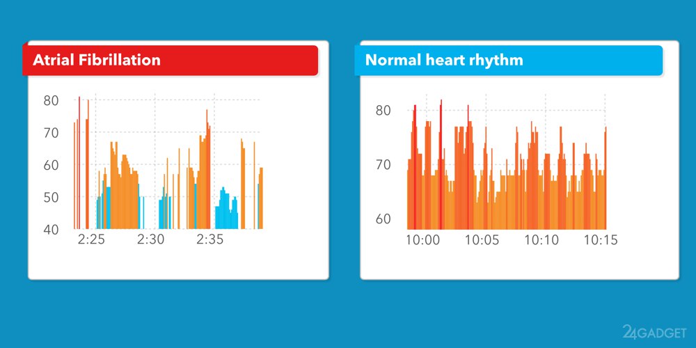 приложение Cardiogram для смарт-часов Apple Watch картинка